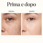 DermaPoint-Penna estetica con display digitale