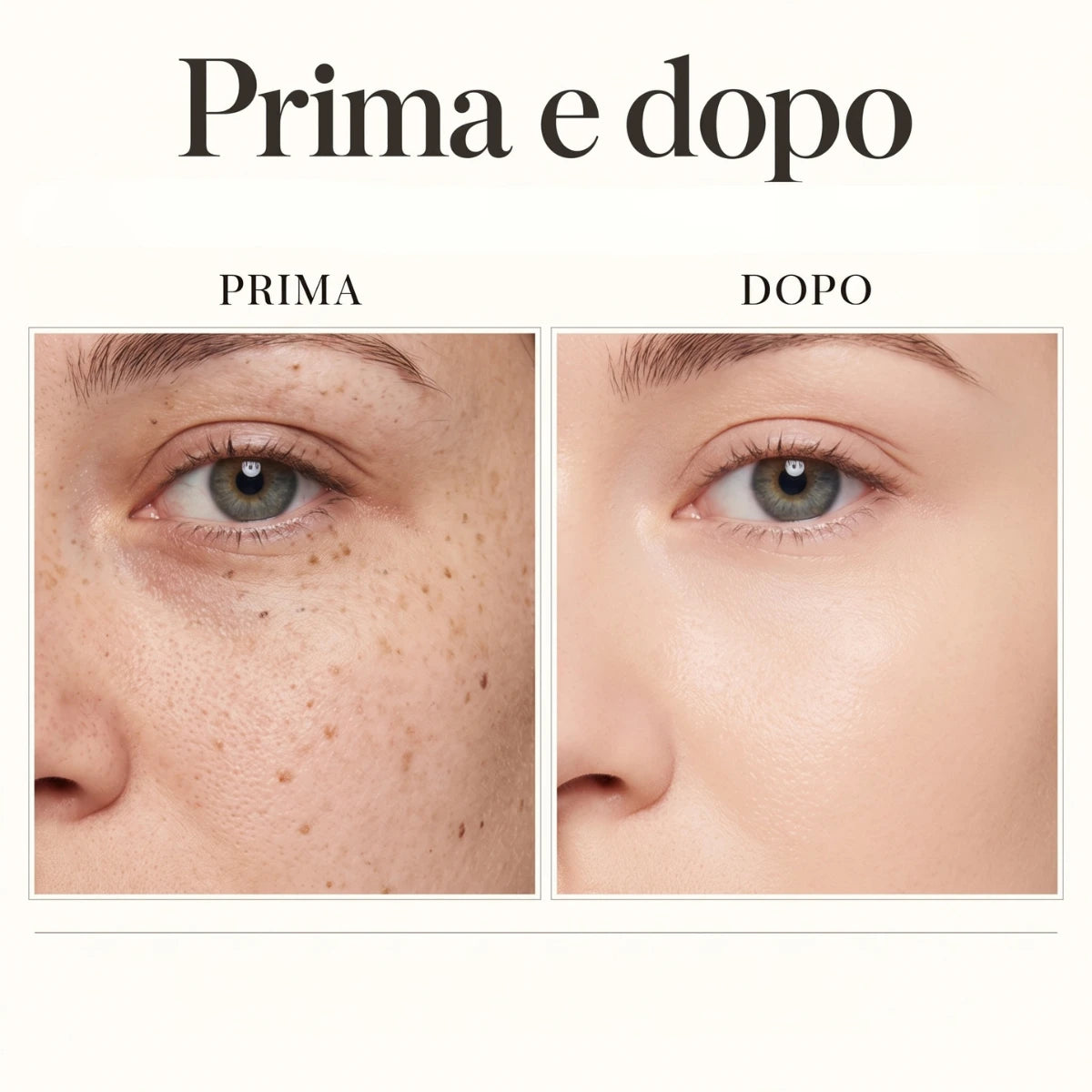 DermaPoint-Penna estetica con display digitale