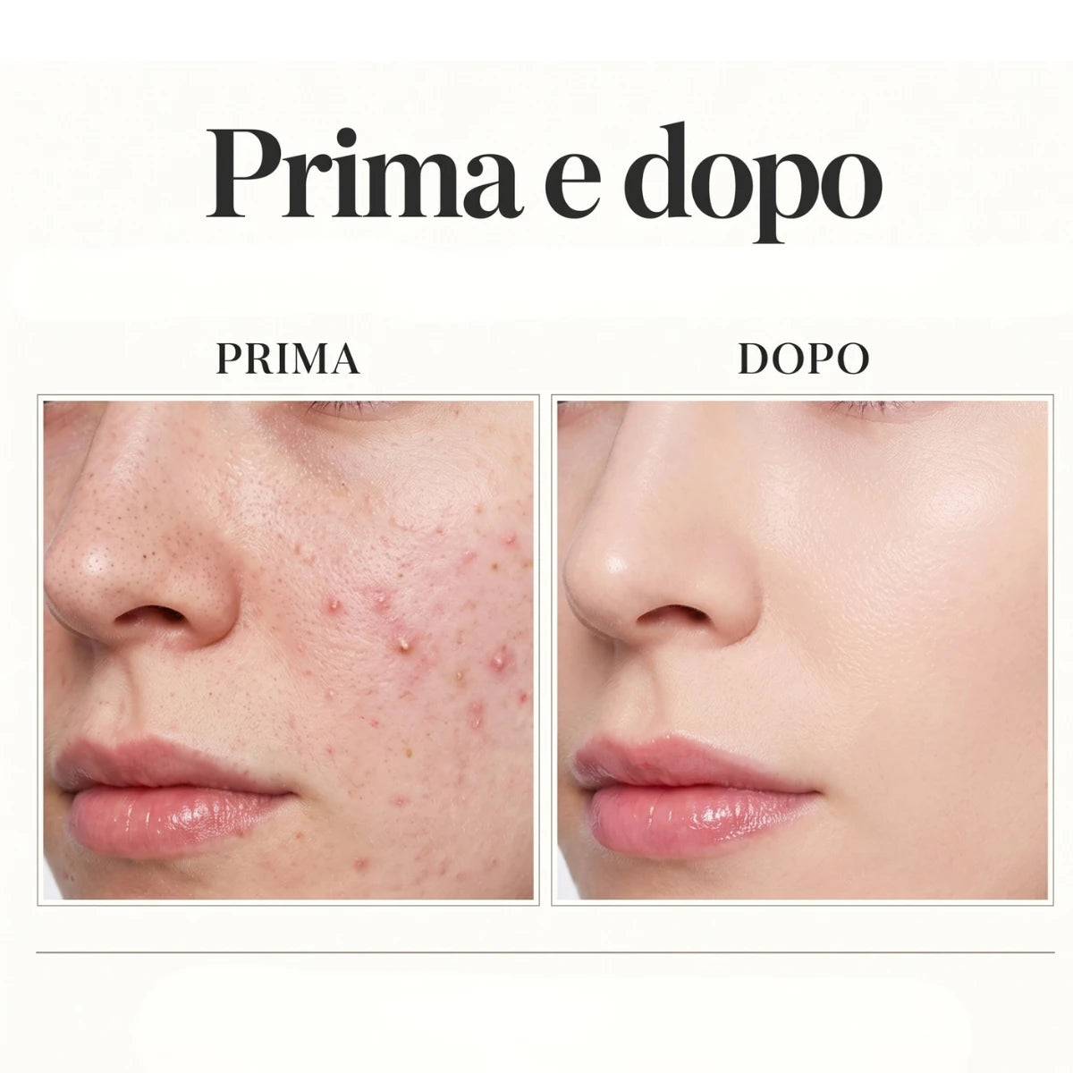 DermaPoint-Penna estetica con display digitale