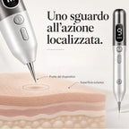 DermaPoint-Penna estetica con display digitale